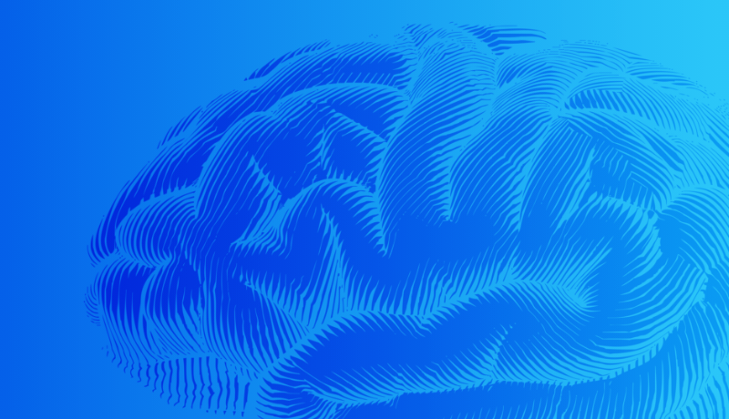 Brain image
